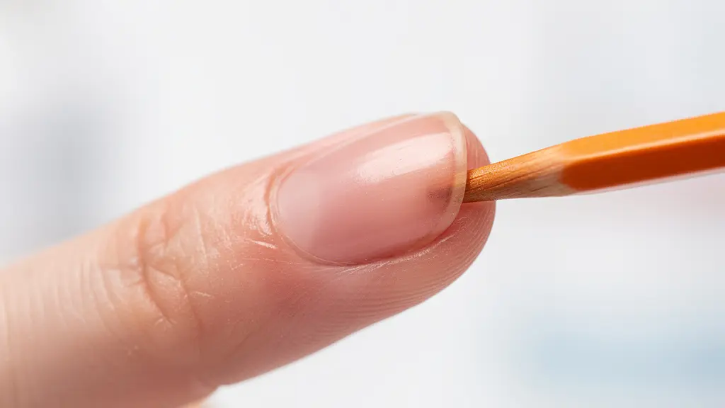 Side view demonstration of pressure being applied to proximal nail fold transferring to matrix