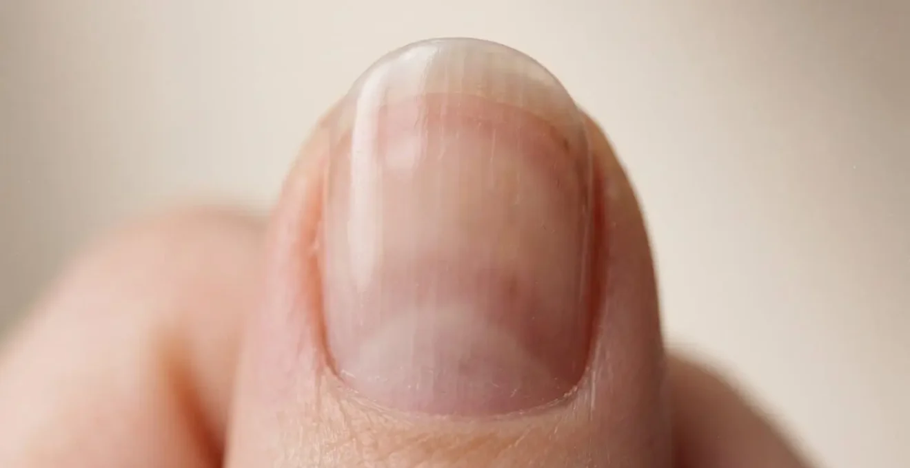 Extreme macro shot of translucent jelly nail polish on natural nails showing the blurring effect on ridges and imperfections